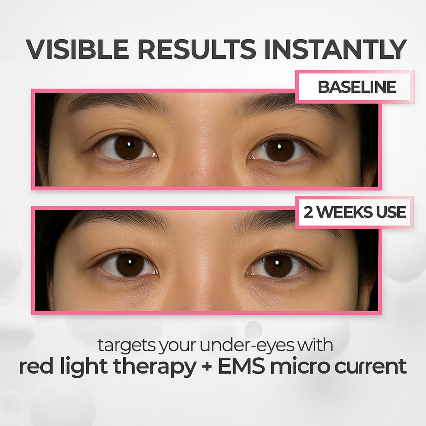 SolaraEyes Under-Eye Red Light Therapy