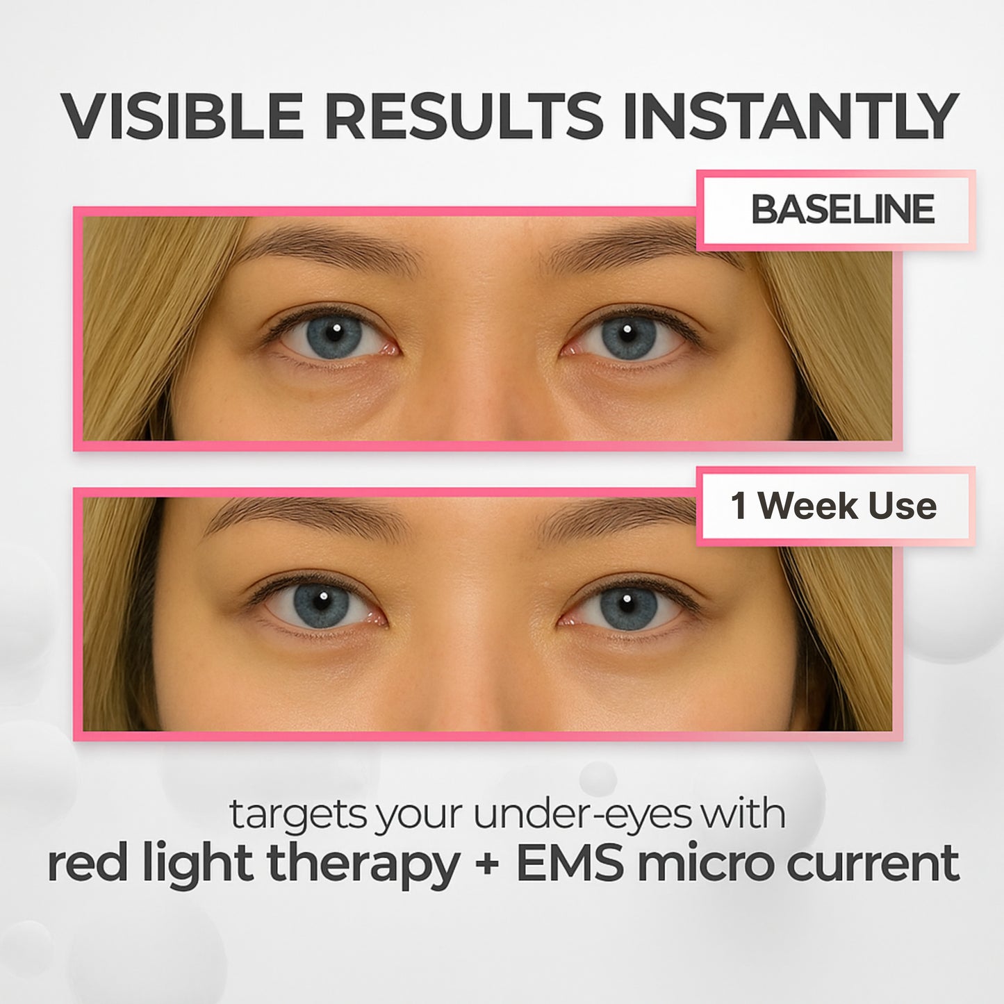 SolaraEyes Under-Eye Red Light Therapy