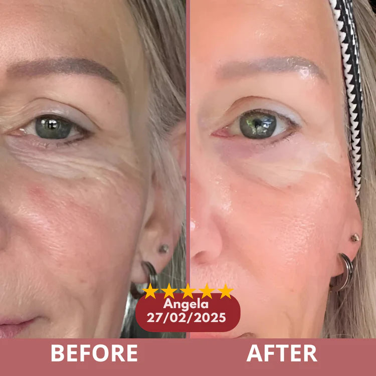 Before and after results