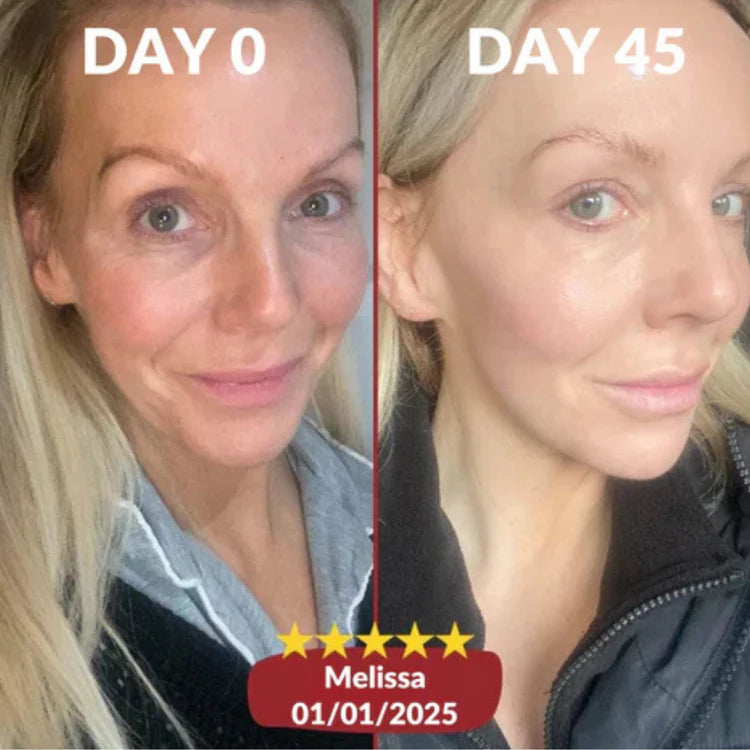 Before and after results