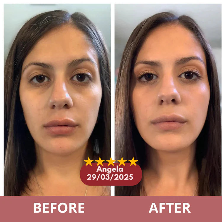 Before and after results