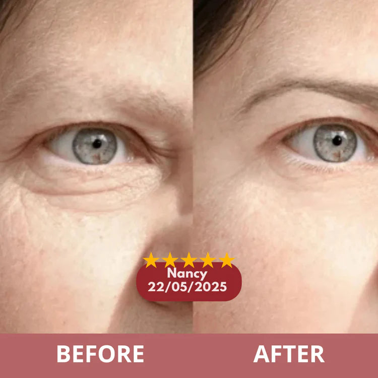 Before and after results