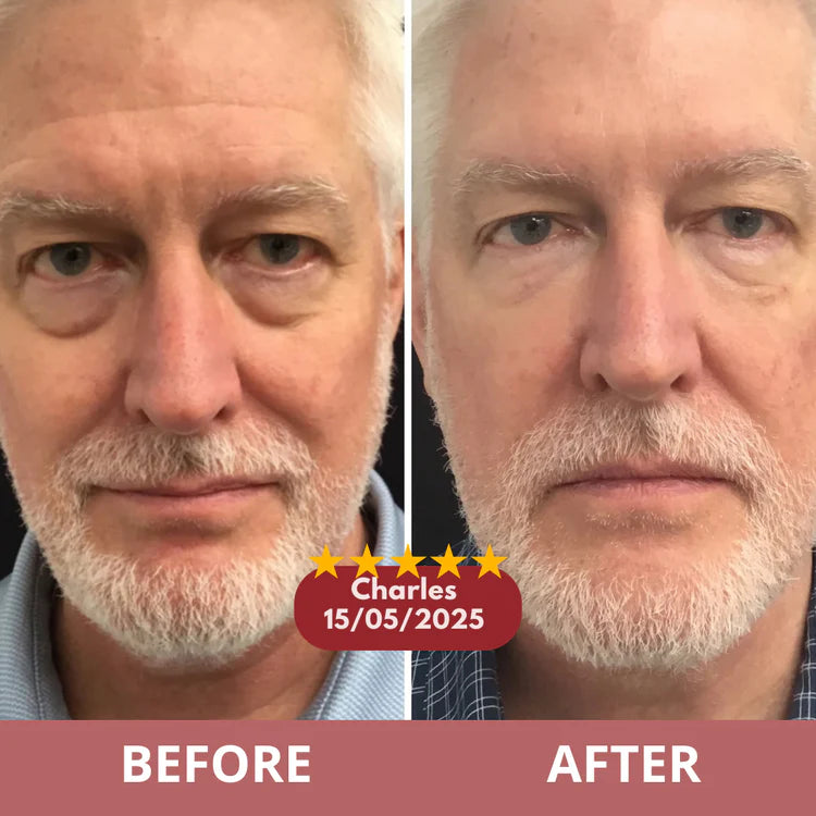 Before and after results