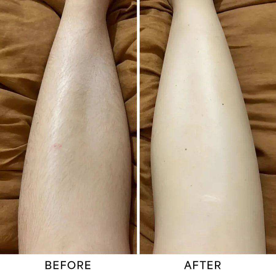 Before and after results