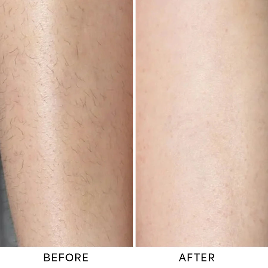 Before and after results