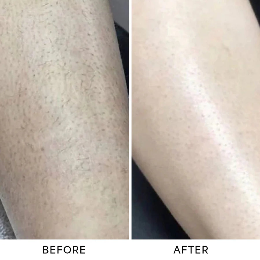 Before and after results