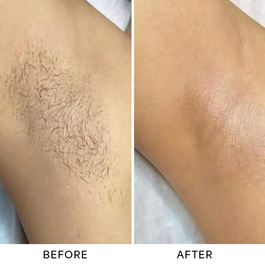 Before and after results