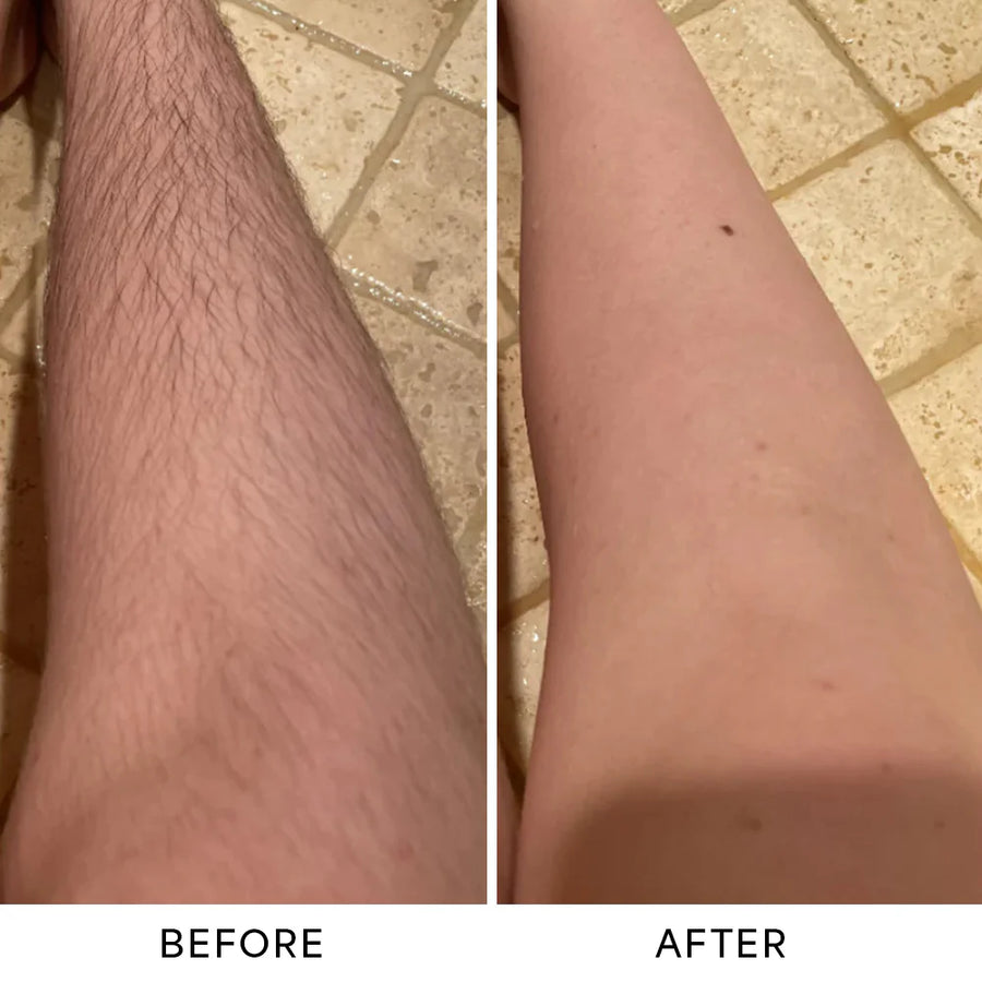 Before and after results